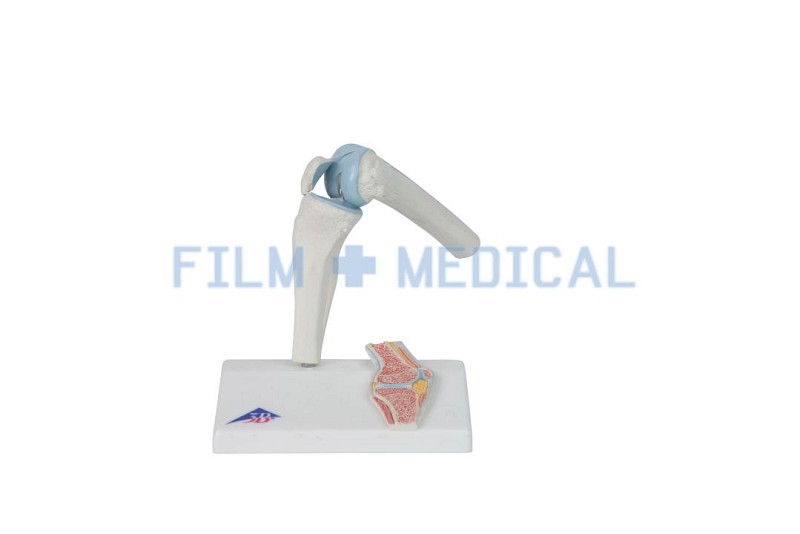 Knee Joint Model 